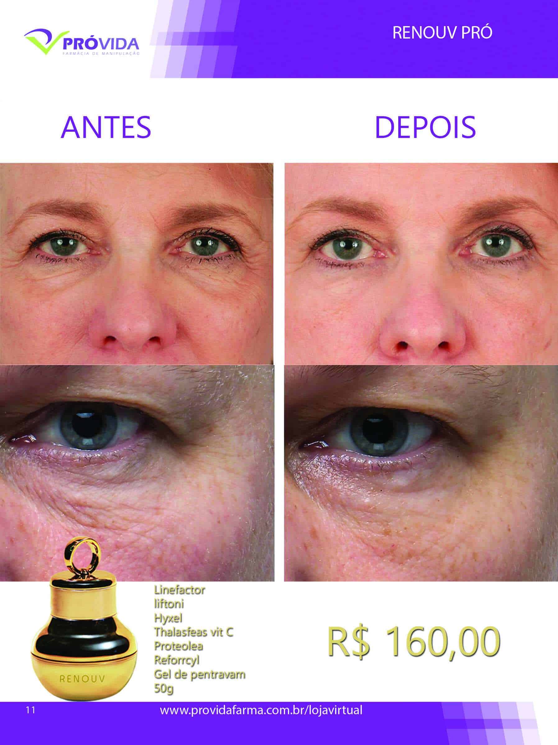Renouv Creme Anti Idade 50 g - Pró Vida Farma